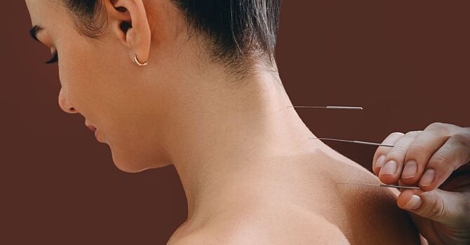 Chinese Herbal Medicine
